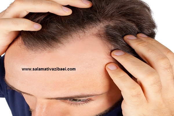عوارض پرخطر کاشت موی سر