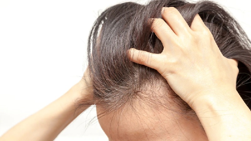 علل دلمه روی پوست سر چیست؟ علائم و درمان خانگی  دلمه روی پوست سر 