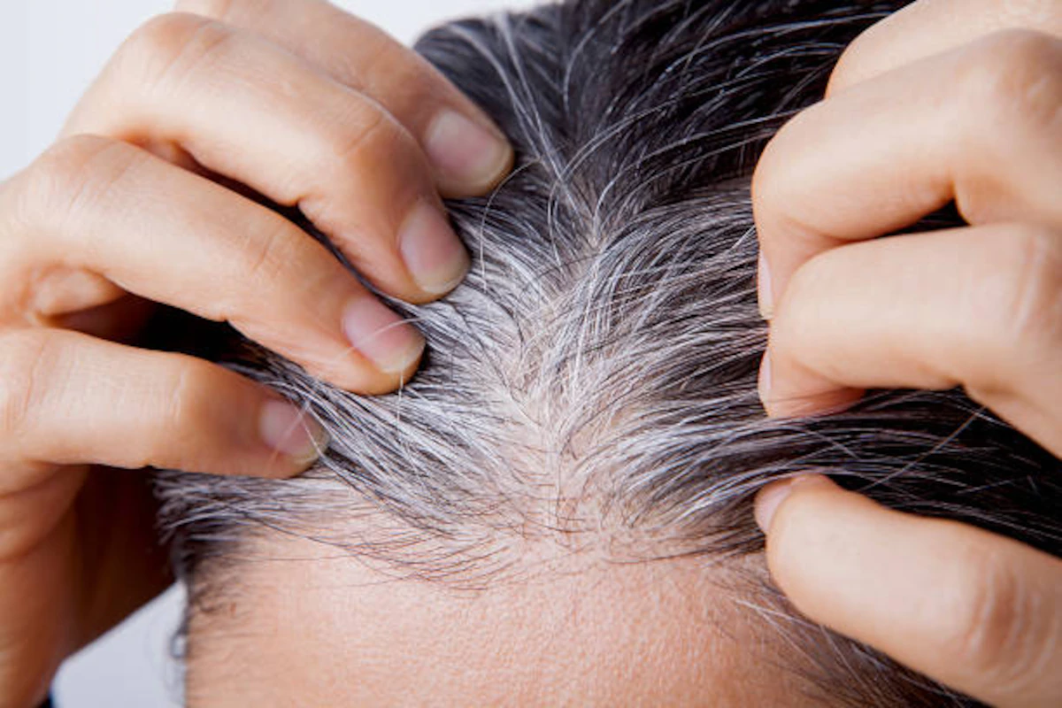 درمان سفیدی مو و پیشگیری از موهای خاکستری