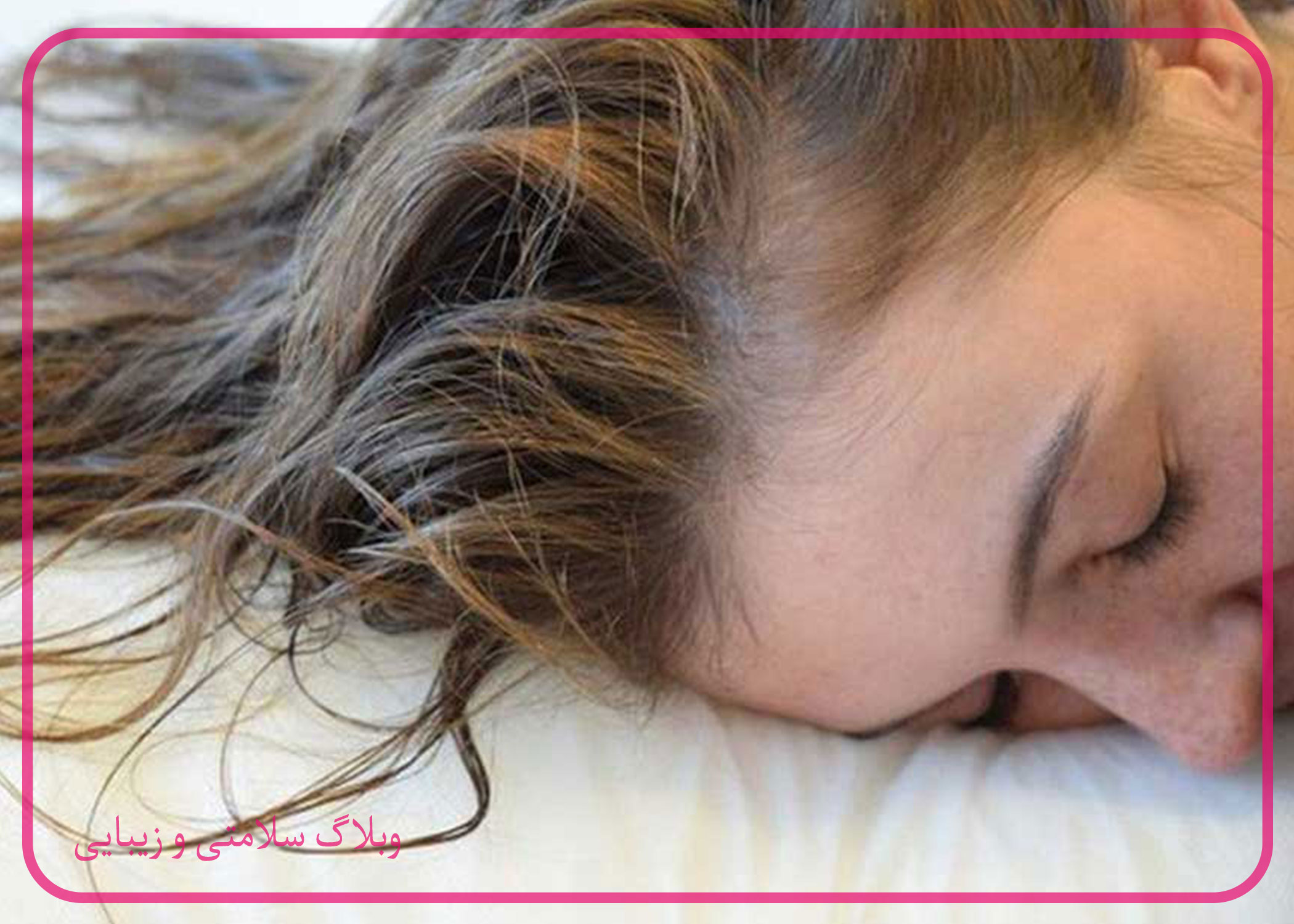 تأثیر کم خوابی بر ریزش مو
