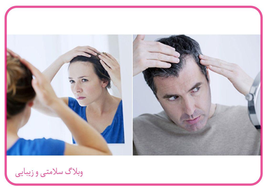 انواع خط مو در زنان و مردان