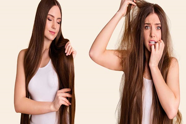 هیدروکسی تراپی مو چیست؟ فواید هیدروکسی تراپی مو و نحوه انجام آن