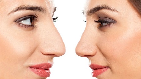 تمرینات ساده و نحوه انجام ماساژ بینی برای حفظ فرم بینی و خوش فرم شدن بینی