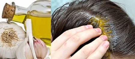 فواید سیر برای مو و نحوه استفاده از سیر برای تقویت رشد مو و مراقبت از مو