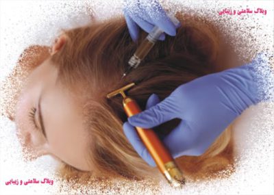 هیرفیلر(پرکننده مو) و فیلرمو چیست؟استفاده از هیرفیلربرای جلوگیری از ریزش مو؟ درمان مو و بازیابی سلامتی پوست سر با هیرفیلر