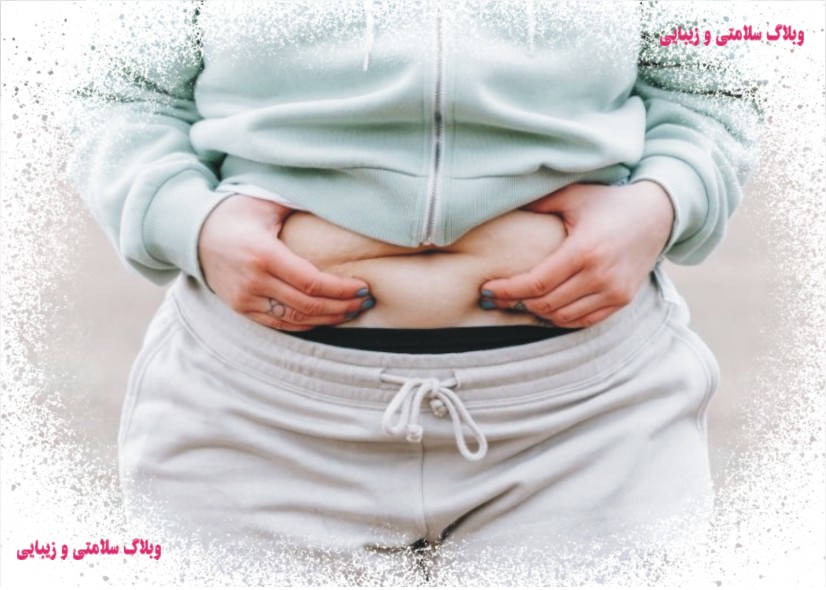 چاقی چیست؟ انواع روش های کاهش چربی بدن چگونه است؟ معرفی درمان های نیمه تهاجمی حذف چربی؟