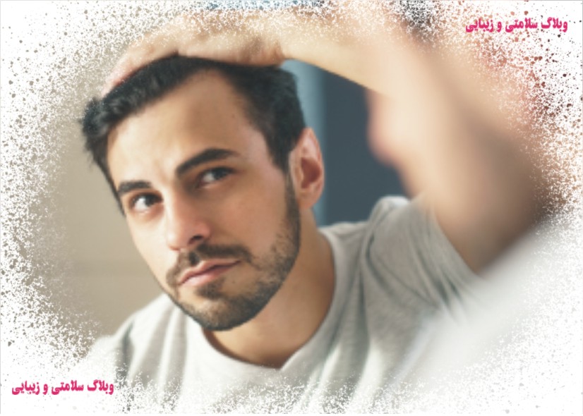 امکان و دلایل ریزش مو بعد از کاشت مو، الگوهای طاسی مردانه و شایع ترین عارضه بعد از کاشت مو چیست؟