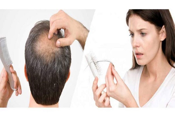علل ریزش مو در زنان و مردان و درمان فوری و بدون بازگشت ریزش مو در کمتر از دو هفته با شامپو ضد ریزش مو 