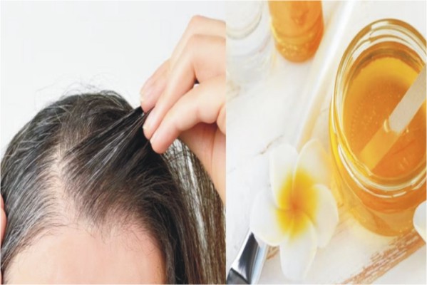 عسل درمانی مو چیست؟ فواید، عوارض و نحوه استفاده از عسل برای تقویت مو