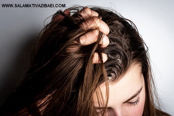 علل و علائم خشکی پوست سر و موهای چرب، درمان چربی مو و خشکی پوست سر